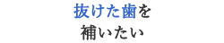 抜けた歯を補いたい